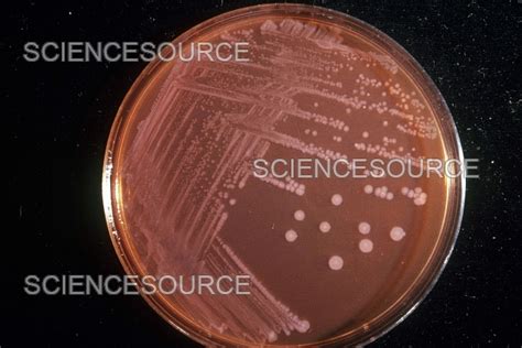 Culture media for Salmonella typhi and paratyphi.